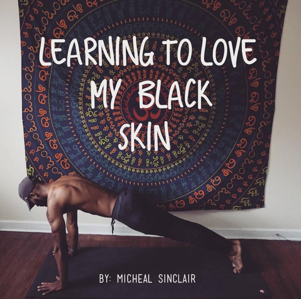 Learning-to-love-the-skin-i-am-in Learning to love my black skin - Micheal Sinclair